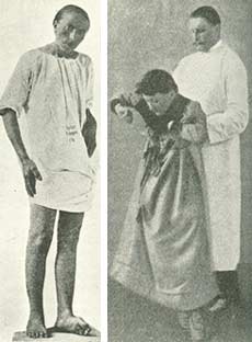 patient hos den franske læge Charcot.